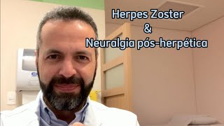 NEURALGIA PÓSHERPÉTICA E HERPES ZOSTER [upl. by Nedmac515]