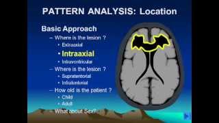 Brain Lesion Location Part 1flv [upl. by Enert854]