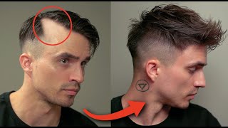 6 Brilliant Hairstyles To Hide Receding Hair amp Big Foreheads [upl. by Eitsud]