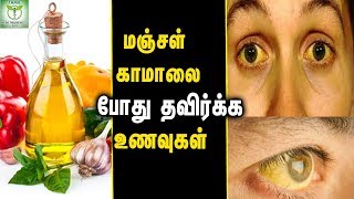 Foods To Avoid During Jaundice  Health tips In Tamil [upl. by Hakan]