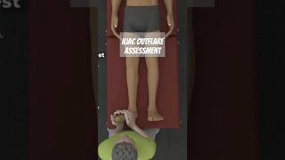 Iliac Outflare Assessment [upl. by Loux384]