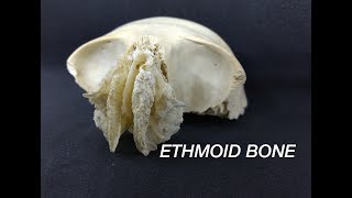 ETHMOID BONE [upl. by Melita]