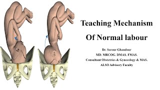 Mechanism of Normal labour  Teaching Station for Part 3 MRCOG [upl. by Yran958]