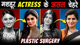 Famous ACTRESSES के असली चेहरे जो 99 लोग नहीं जानते  SHOCKING Plastic Surgery Of Famous Actresses [upl. by Janek]