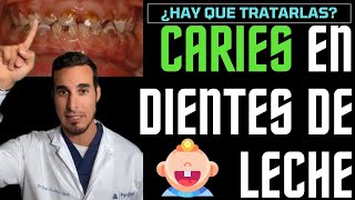 Las CARIES en niños con DIENTES DE LECHE no hace falta tratarlas 🤥¡MENTIRA [upl. by Anneis]