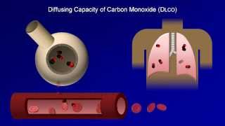 Pulmonary Function Tests PFT Lesson 4  DLCO [upl. by Znarf]