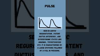 Types of Arterial Pulses  Cardiology [upl. by Gala510]