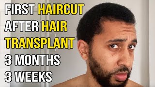 First Haircut Post Hair Transplant 3 months and 3 Week SelfCut FUE Turkey Cosmedica Clinic [upl. by Liesa]