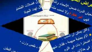 oxyuris طفيليات ديدان الحرقص  الأقصورة [upl. by Liponis]