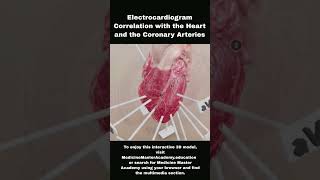 Electrocardiogram Correlation ecg heart stemi nstemi heartattack ekg electrocardiogram [upl. by Bodnar]