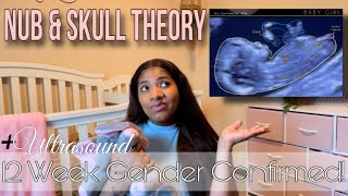 12 Week Ultrasound Baby Gender Prediction ITS A GIRL🎀 Nub Theory amp Skull Theory Gender Reveal [upl. by Sremlahc]