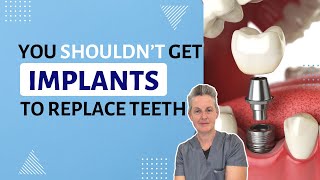 Dont Get Screwed Heres Why You Shouldnt Get Dental Implants [upl. by Novar]