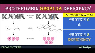 Lecture 52 Prothrombin G20210A mutation [upl. by Seidel]