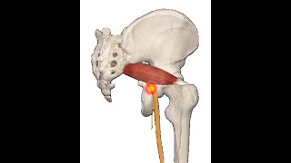 How to do a Piriformis release [upl. by Kcam]