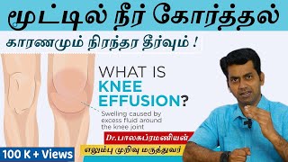 Knee Effusion  Causes  Treatment  மூட்டுகளில் நீர் கோர்த்தல் காரணமும் தீர்வும்Dr Balasubramanian [upl. by Wheeler323]