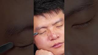 tutorial double eyelids shorts [upl. by Donell]