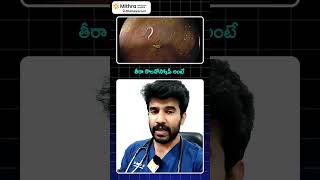 తిన్న వెంటనే మోషన్ వెళ్తున్నారా అయితే ఈ వీడియో చూడండిDrVikranth Chunduri [upl. by Kuhn]