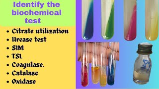 Biochemical Test  Bacterial Identification Technique Microbiology Practical Exam bacteriology [upl. by Warford]