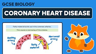 Coronary Heart Disease  GCSE Biology [upl. by Lyda]