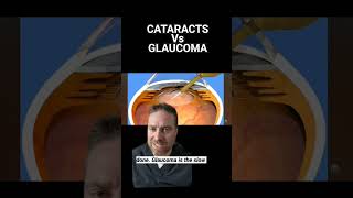 Cataracts Vs Glaucoma What Is The Difference [upl. by Nadda]