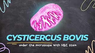 Cysticercus bovis under the microscope with Haematoxylin and Eosin HampE stain [upl. by Relyk319]