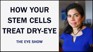 PRP drops How Your Own Stem Cells Can Treat Dry Eye  The Eye Show [upl. by Roselane321]