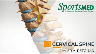 CERVICAL RADICULOPATHY Common Symptoms and Treatment Options  Dr Javier Reto [upl. by Juana]