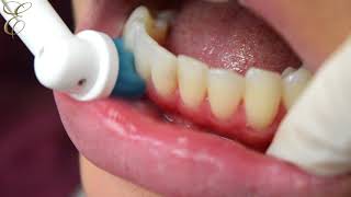 How to use electric tooth brush properly [upl. by Rostand]