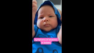 Eczema in babies amp children the causes symptoms and treatments [upl. by Brosine49]