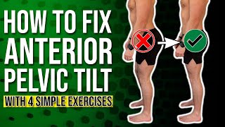 Anterior Pelvic Correction Exercises  The 4 BEST Ones You Can Do [upl. by Thurstan451]