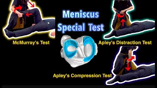 Meniscus Tear McMurrays Test Apley’s Test Function and Anatomy of Meniscus Special Test MCL LCL [upl. by Ernesta]