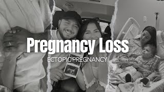 Pregnancy Loss  My Ectopic Pregnancy Story [upl. by Hannahs]