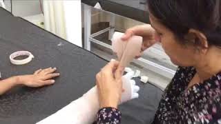 BANDAGING TECHNIQUES FOR UPPER EXTREMITY LYMPHEDEMA [upl. by Kreager]