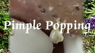 Pimple amp Blackheads Popping  24 [upl. by Irtemed]