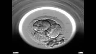 Embryoscope at Fertility Specialists of WA [upl. by Ahtivak530]