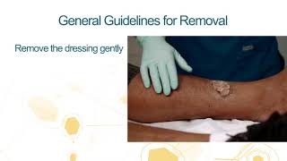 Medihoney Product Guidelines for Removal [upl. by Cerallua]