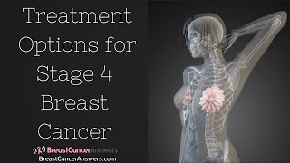 What Are the Treatment Options for Stage 4 Breast Cancer [upl. by Doi]