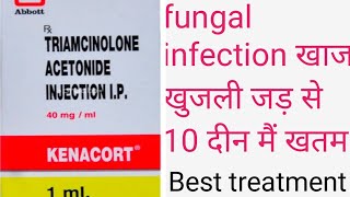 fungal infection treatmentfungal infection Ko 10 din mein khatm karo दाऊद खुजली treatment in Hindi [upl. by Zonnya519]