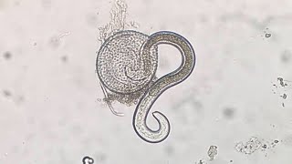 Parasitosis causada por Toxocara spp [upl. by Obmar939]