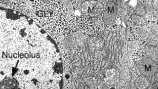 233 Identify structures from electron micrographs of liver cells [upl. by Aneeras]