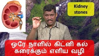 ஒரே நாளில் கிட்னி கல் கரைக்கும் எளிய வழி  healer baskar kidney stones  kidney healer baskar [upl. by Keri310]