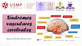 Medicina 1  Sesión 14A  Síndromes vasculares cerebrales  Dyanira Santos  20242 [upl. by Mayce85]