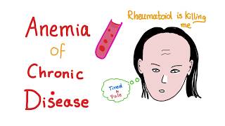 Anemia of Chronic Disease  Anemia of Inflammation All you need to know  Hematology Series [upl. by Kenrick]