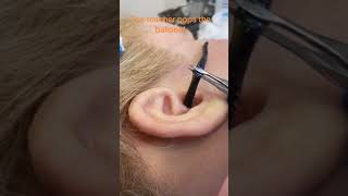 How to Remove worms inside the ear [upl. by Tada]