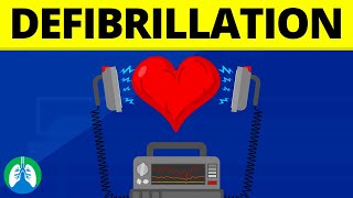 Defibrillation Medical Definition  Quick Explainer Video [upl. by Iraam912]