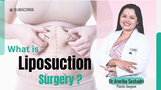 What is Liposuction in plastic surgery By Dr Amrika Seshadri plasticsurgeonskincare [upl. by Yelrebmik]