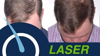 Laser Therapy LLLT  NonSurgical way to Grow your Hair [upl. by Ahtiekahs]