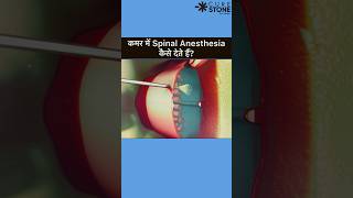 Spinal Anesthesia  How spinal is given  Epidural Anesthesia rirssurgery pregenency [upl. by Mukund]