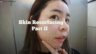 Venus Viva Skin Resurfacing Part 2  Erna Limdaugh [upl. by Zerep]