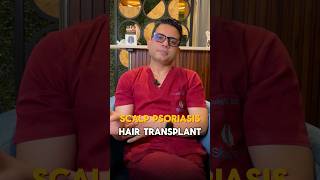 Hair Transplant in Scalp Psoriasis   Learn from the hair transplant surgeon  shorts [upl. by Anined382]